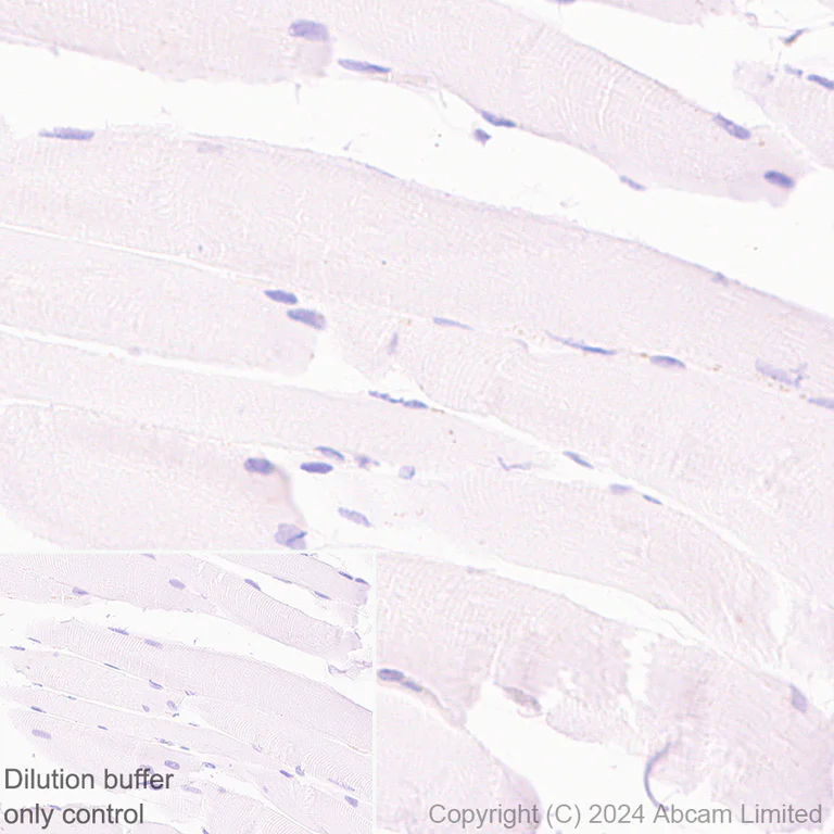 Immunohistochemistry (Formalin/PFA-fixed paraffin-embedded sections) - HRP Anti-Aquaporin 2 antibody [EPR21080] (AB325038)