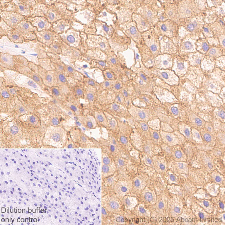 Immunohistochemistry (Formalin/PFA-fixed paraffin-embedded sections) - HRP Anti-Asialoglycoprotein Receptor 1/HL-1 antibody [EPR22642-17] (AB323727)