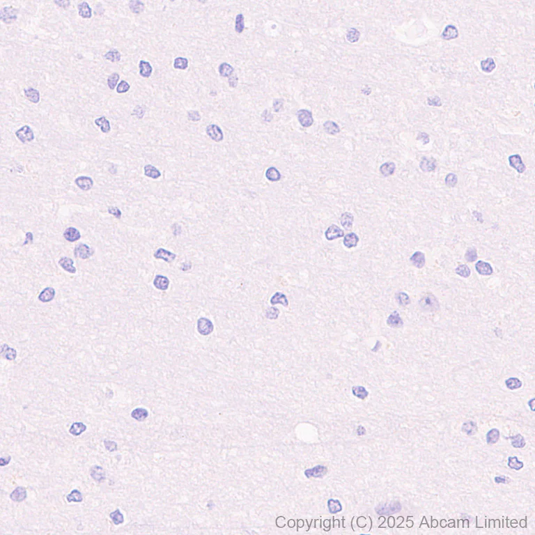 Immunohistochemistry (Formalin/PFA-fixed paraffin-embedded sections) - HRP Anti-Asialoglycoprotein Receptor 1/HL-1 antibody [EPR22642-17] (AB323727)