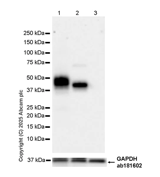 Western blot - HRP Anti-Asialoglycoprotein Receptor 1/HL-1 antibody [EPR22642-17] (AB323727)