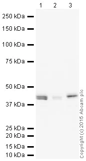 Western blot - HRP Anti-Aspartate Aminotransferase + FABP-1 antibody [EPR12145] (AB201765)