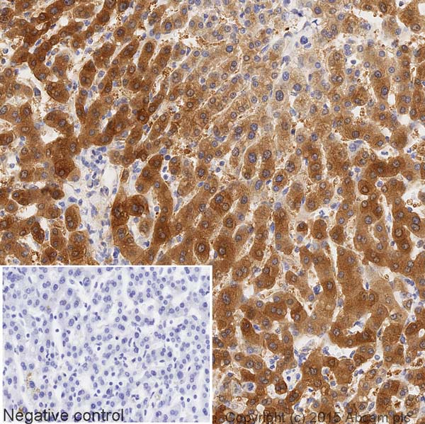 Immunohistochemistry (Formalin/PFA-fixed paraffin-embedded sections) - HRP Anti-ASS1 antibody [EPR12398] (AB209018), expandable thumbnail