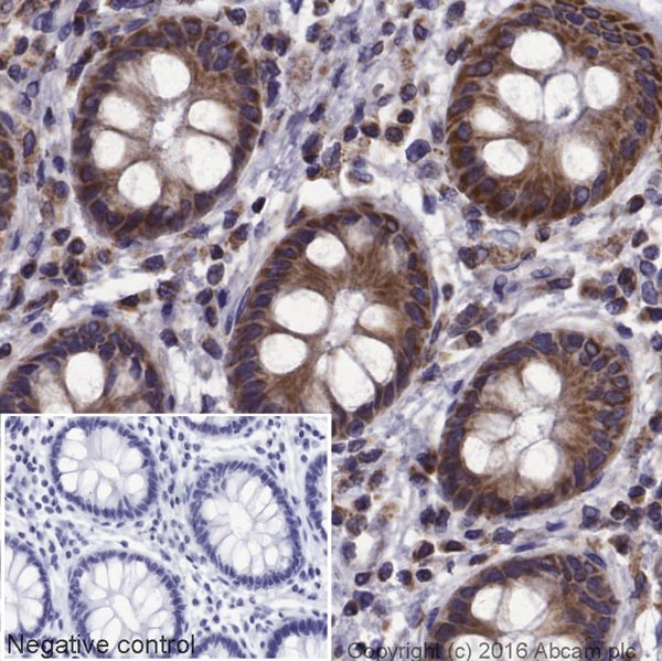 Immunohistochemistry (Formalin/PFA-fixed paraffin-embedded sections) - HRP Anti-Bak antibody [Y164] (AB199516)