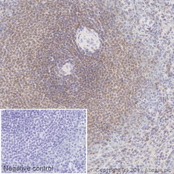 Immunohistochemistry (Formalin/PFA-fixed paraffin-embedded sections) - HRP Anti-Bcl-2 antibody [EPR17509] (AB209039)
