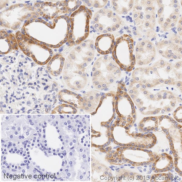 Immunohistochemistry (Formalin/PFA-fixed paraffin-embedded sections) - HRP Anti-Bcl-XL antibody [E18] (AB200600)