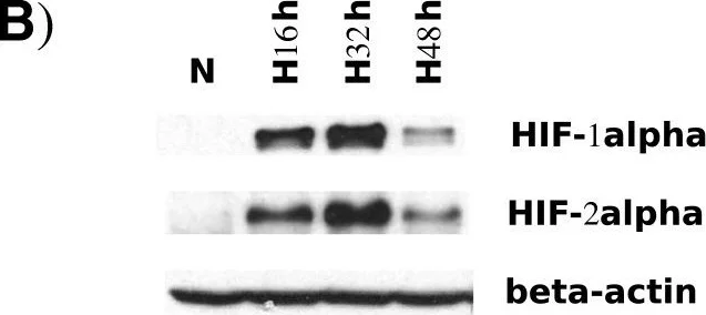 Western blot - HRP Anti-beta Actin antibody [AC-15] - Loading Control (AB49900)