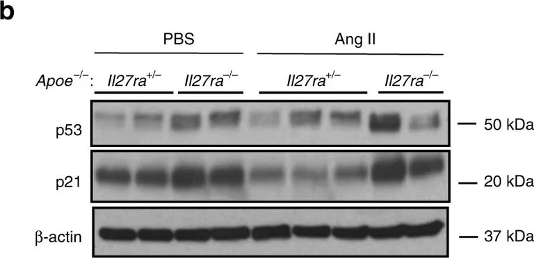 Western blot - HRP Anti-beta Actin antibody [AC-15] - Loading Control (AB49900)