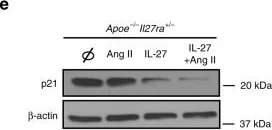Western blot - HRP Anti-beta Actin antibody [AC-15] - Loading Control (AB49900)