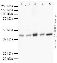 Western blot - HRP Anti-beta Actin antibody [mAbcam 8226] - Loading Control (AB20272), expandable thumbnail