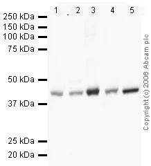 Western blot - HRP Anti-beta Actin antibody [mAbcam 8226] - Loading Control (AB20272)