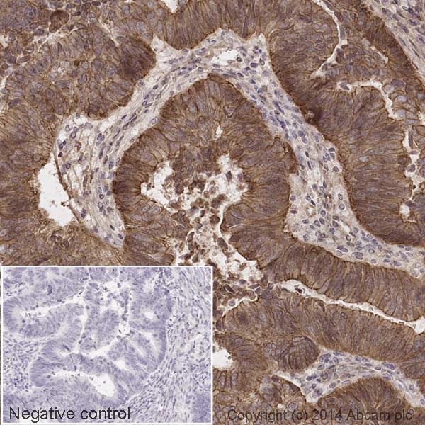 Immunohistochemistry (Formalin/PFA-fixed paraffin-embedded sections) - HRP Anti-beta Catenin antibody [E247] (AB194120), expandable thumbnail