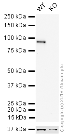 Western blot - HRP Anti-beta Catenin antibody [E247] (AB194120), expandable thumbnail