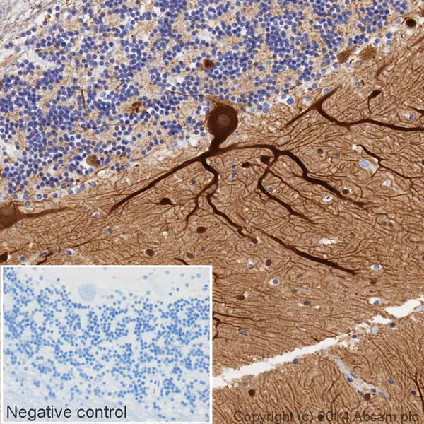 Immunohistochemistry (Formalin/PFA-fixed paraffin-embedded sections) - HRP Anti-beta III Tubulin antibody [2G10] - Neuronal Marker (AB196638)