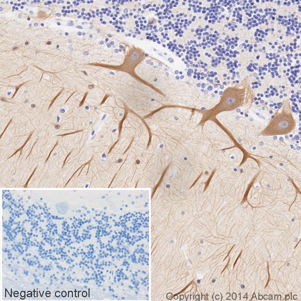 Immunohistochemistry (Formalin/PFA-fixed paraffin-embedded sections) - HRP Anti-beta III Tubulin antibody [2G10] (AB196638), expandable thumbnail