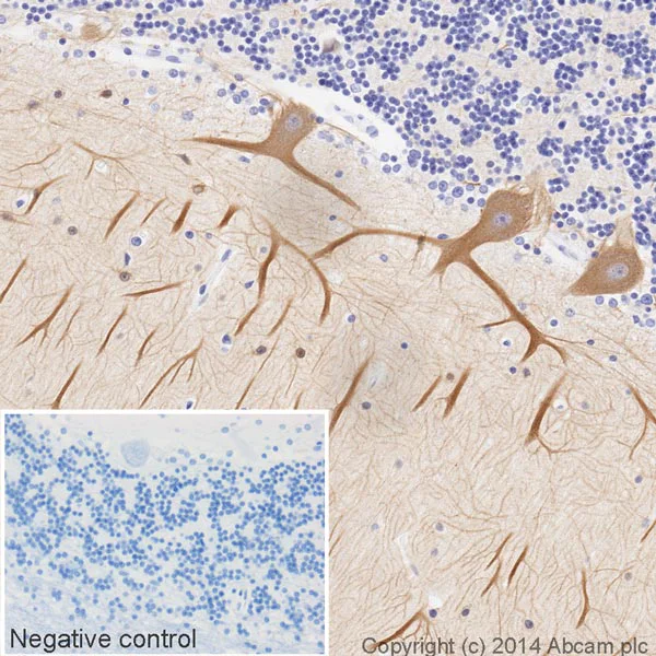 Immunohistochemistry (Formalin/PFA-fixed paraffin-embedded sections) - HRP Anti-beta III Tubulin antibody [2G10] - Neuronal Marker (AB196638)