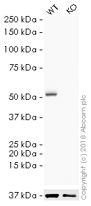 Western blot - HRP Anti-beta III Tubulin antibody [2G10] - Neuronal Marker (AB196638), expandable thumbnail