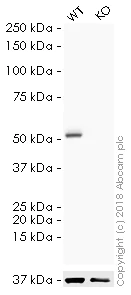 Western blot - HRP Anti-beta III Tubulin antibody [2G10] - Neuronal Marker (AB196638)