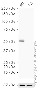 Western blot - HRP Anti-beta III Tubulin antibody [EP1569Y] - Neuronal Marker (AB190574)