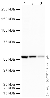 Western blot - HRP Anti-beta IV Tubulin antibody [ONS.1A6] (AB204454)