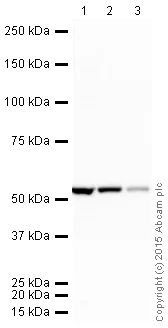 Western blot - HRP Anti-beta IV Tubulin antibody [ONS.1A6] (AB204454)