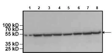 Western blot - HRP Anti-beta Tubulin antibody [BT7R] - Loading Control (AB173840)
