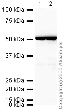 Western blot - HRP Anti-beta Tubulin antibody - Loading Control (AB21058)