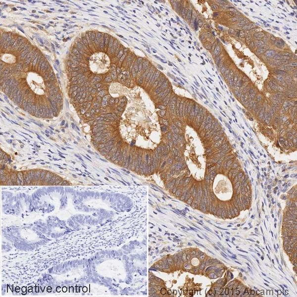 Immunohistochemistry (Formalin/PFA-fixed paraffin-embedded sections) - HRP Anti-Bid antibody [Y8] (AB201754)