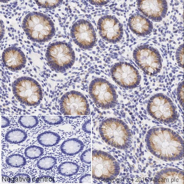 Immunohistochemistry (Formalin/PFA-fixed paraffin-embedded sections) - HRP Anti-BMP4 antibody [EPR6211] (AB200795)