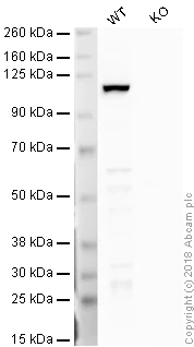 Western blot - HRP Anti-BRD2 antibody [EPR7642] (AB198536)