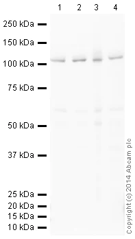 Western blot - HRP Anti-BRD2 antibody [EPR7642] (AB198536)