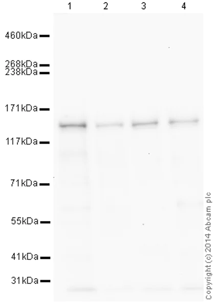 Western blot - HRP Anti-Brd4 antibody [EPR5150(2)] (AB197609)