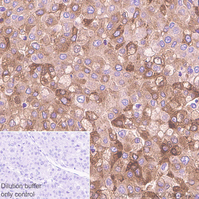 Immunohistochemistry (Formalin/PFA-fixed paraffin-embedded sections) - HRP Anti-C Reactive Protein antibody [Y284] (AB307473)