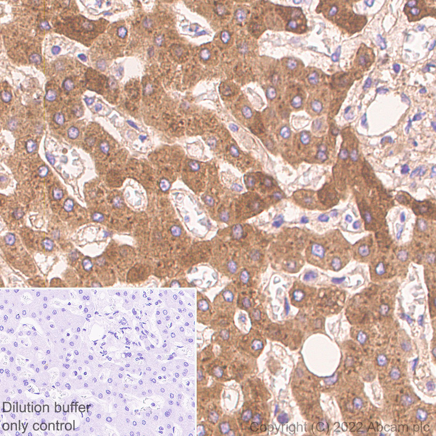 Immunohistochemistry (Formalin/PFA-fixed paraffin-embedded sections) - HRP Anti-C Reactive Protein antibody [Y284] (AB307473), expandable thumbnail