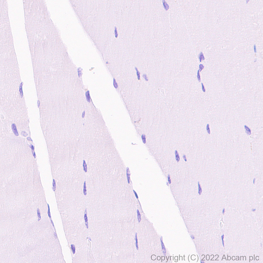Immunohistochemistry (Formalin/PFA-fixed paraffin-embedded sections) - HRP Anti-C Reactive Protein antibody [Y284] (AB307473), expandable thumbnail