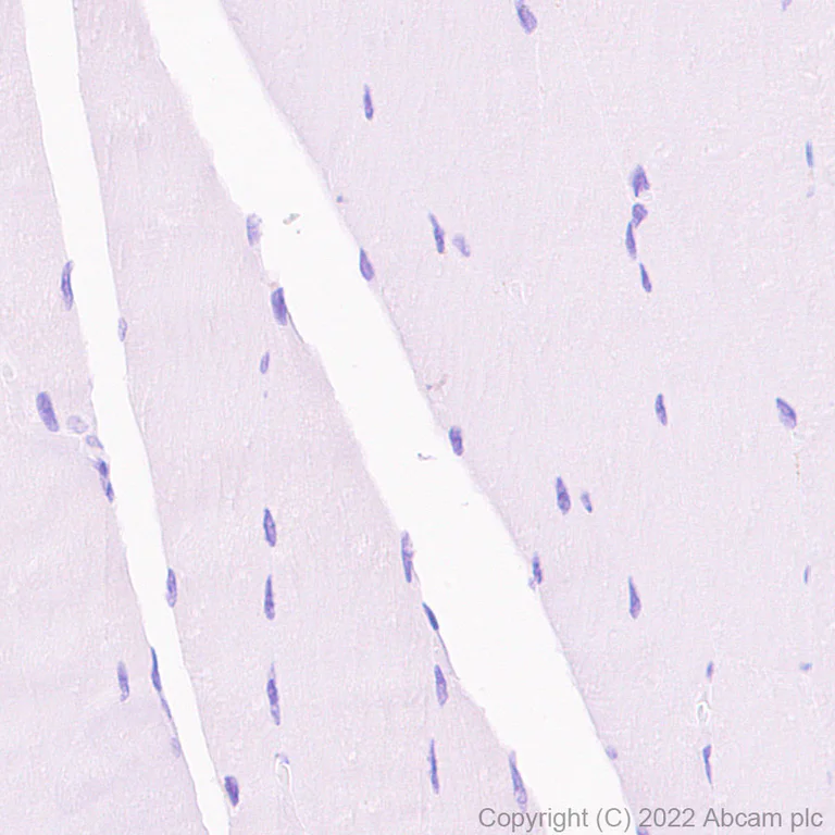 Immunohistochemistry (Formalin/PFA-fixed paraffin-embedded sections) - HRP Anti-C Reactive Protein antibody [Y284] (AB307473)