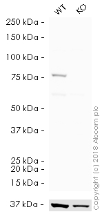 Western blot - HRP Anti-Calnexin antibody [EPR3633(2)] - ER Membrane Marker (AB195198), expandable thumbnail