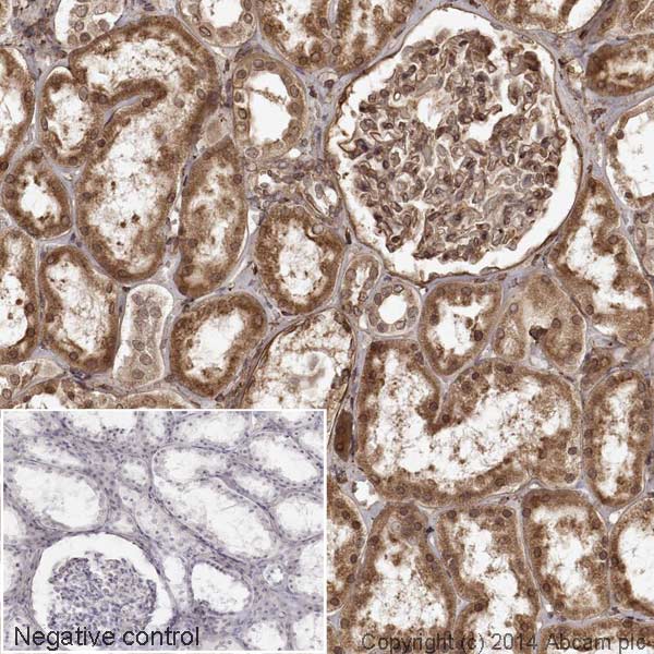 Immunohistochemistry (Formalin/PFA-fixed paraffin-embedded sections) - HRP Anti-Calreticulin antibody [EPR3924] - ER Marker (AB195511)