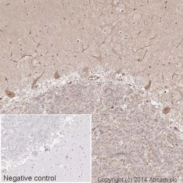 Immunohistochemistry (Formalin/PFA-fixed paraffin-embedded sections) - HRP Anti-CaMKII antibody [EP1829Y] (AB195518)