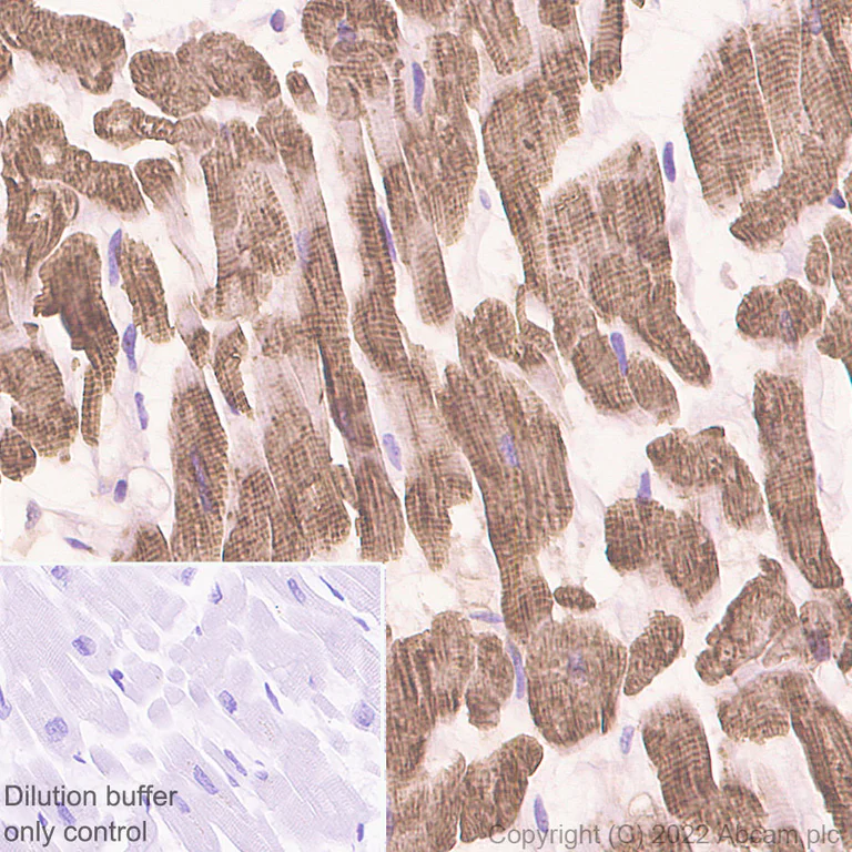 Immunohistochemistry (Formalin/PFA-fixed paraffin-embedded sections) - HRP Anti-Cardiac Troponin I antibody [EP1106Y] (AB305816)
