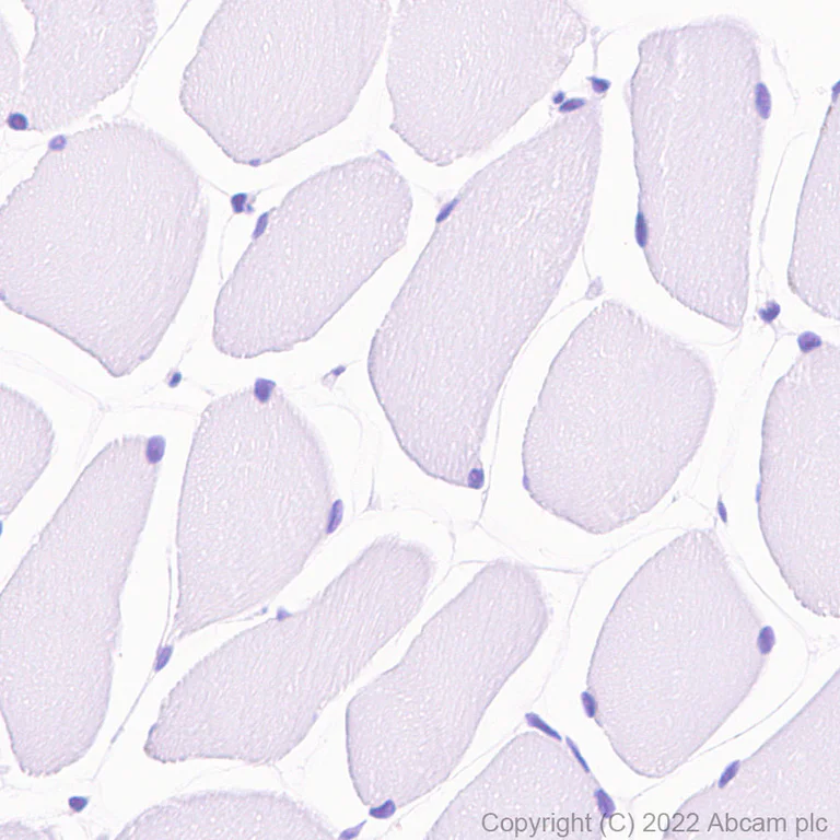 Immunohistochemistry (Formalin/PFA-fixed paraffin-embedded sections) - HRP Anti-Cardiac Troponin I antibody [EP1106Y] (AB305816)
