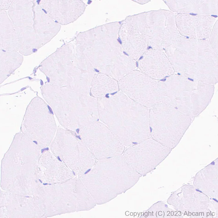 Immunohistochemistry (Formalin/PFA-fixed paraffin-embedded sections) - HRP Anti-Cardiac Troponin I antibody [EPR20307] (AB309163)
