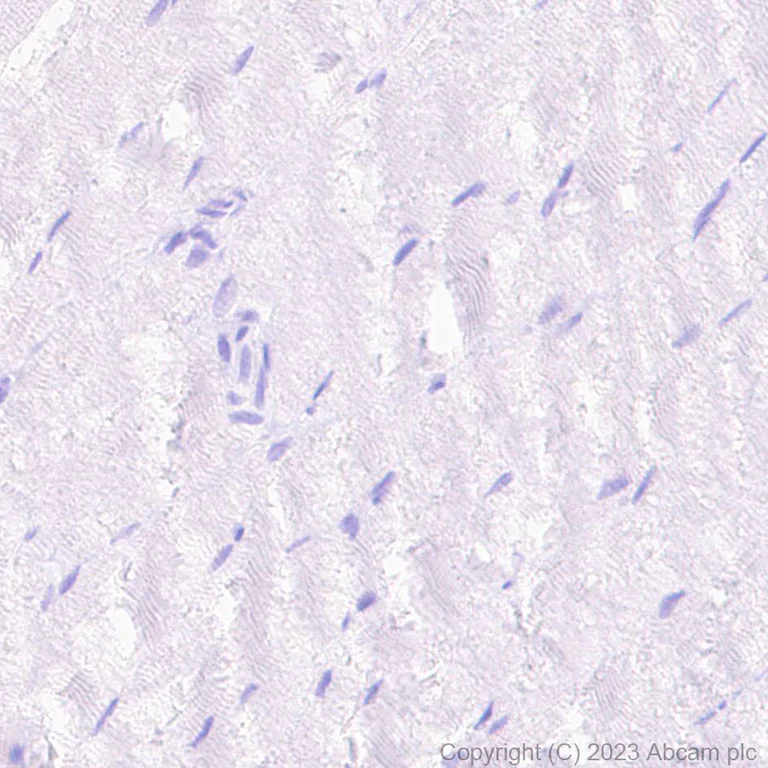 Immunohistochemistry (Formalin/PFA-fixed paraffin-embedded sections) - HRP Anti-Cardiac Troponin I antibody [EPR20307] (AB309163)