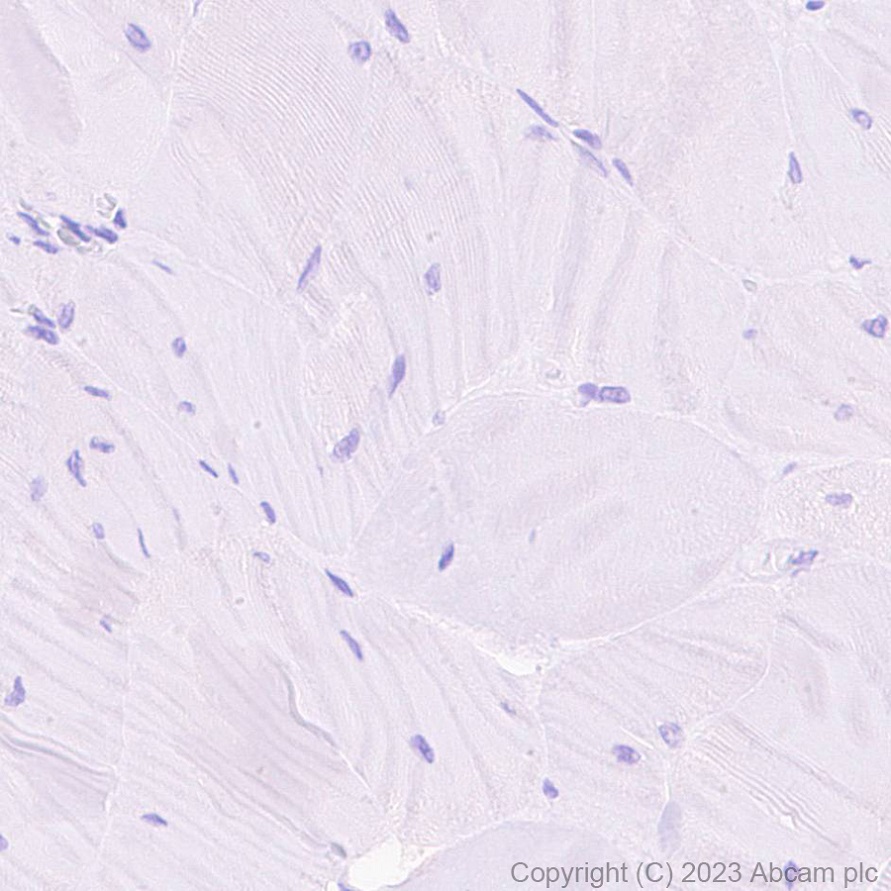 Immunohistochemistry (Formalin/PFA-fixed paraffin-embedded sections) - HRP Anti-Cardiac Troponin I antibody [EPR20307] (AB309163)