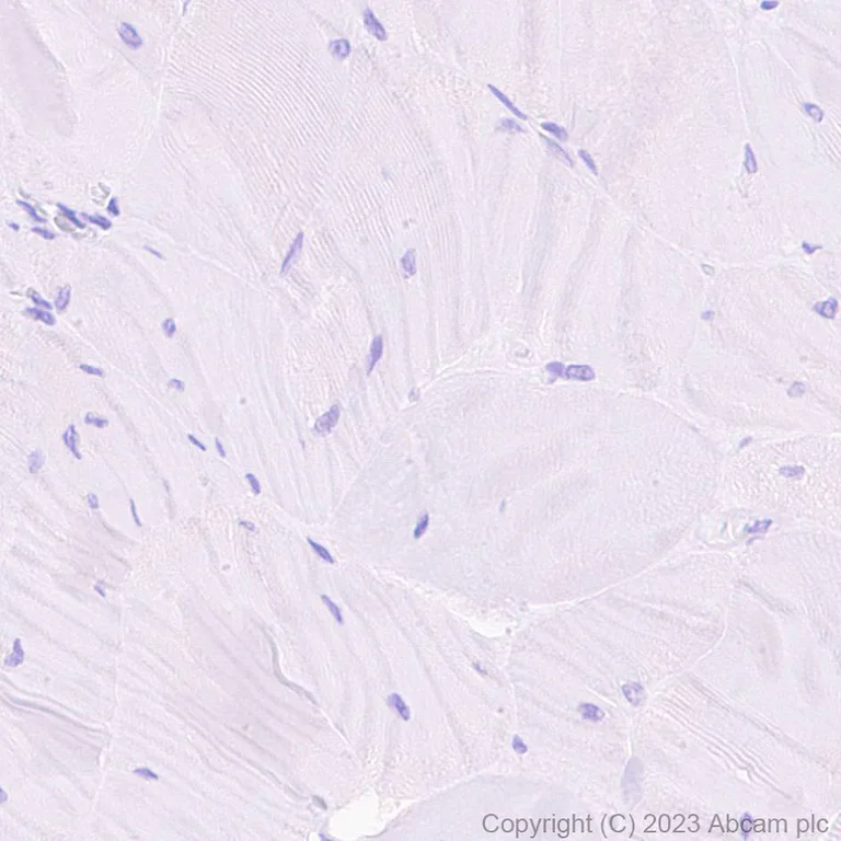 Immunohistochemistry (Formalin/PFA-fixed paraffin-embedded sections) - HRP Anti-Cardiac Troponin I antibody [EPR20307] (AB309163)