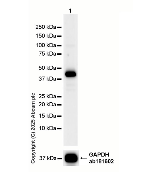 Western blot - HRP Anti-Cathepsin K antibody [EP9403] (AB323778), expandable thumbnail