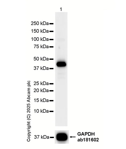 Western blot - HRP Anti-Cathepsin K antibody [EP9403] (AB323778)