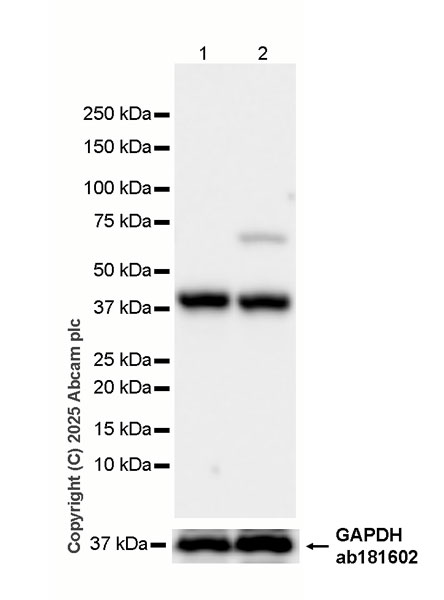Western blot - HRP Anti-Cathepsin K antibody [EP9403] (AB323778), expandable thumbnail