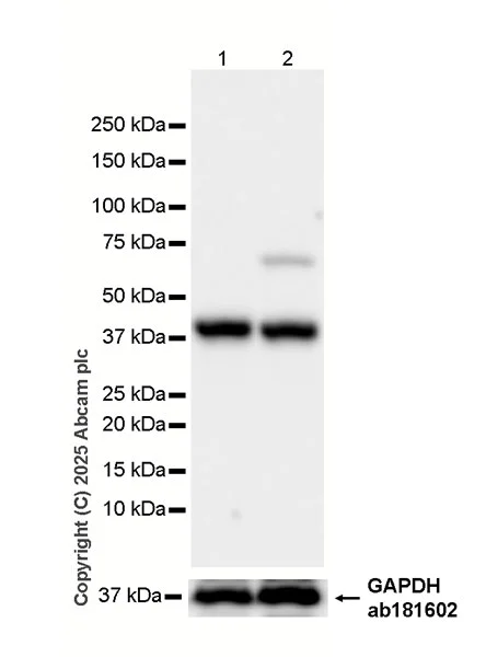 Western blot - HRP Anti-Cathepsin K antibody [EP9403] (AB323778)