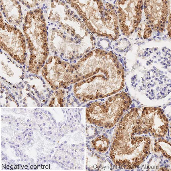 Immunohistochemistry (Formalin/PFA-fixed paraffin-embedded sections) - HRP Anti-Cathepsin L + V antibody [33/2] (AB197278)