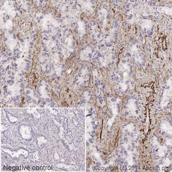 Immunohistochemistry (Formalin/PFA-fixed paraffin-embedded sections) - HRP Anti-Caveolin-1 antibody [E249] - Caveolae Marker (AB193893), expandable thumbnail